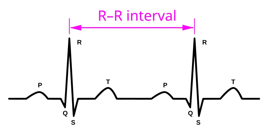 ECG R-R Interval