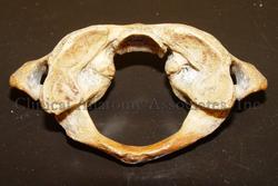 Atlas - First cervical vertebra