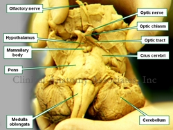 Brainstem. Anteroinferior view