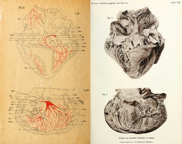 Image from Sunao Tawara MD monograph on the conduction system of the heart