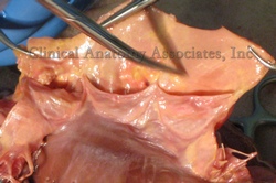 Human aortic valve, cut and spread open