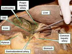 Anteroinferior view of the liver and stomach