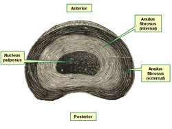 Intervertebral disc, superior view Intervertebral disc, superior view