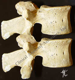 Intervertebral foramen