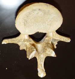 Lumbar vertebra - inferior view