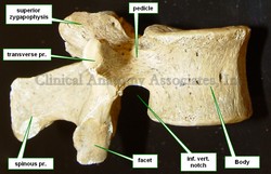 Lumbar vertebra - lateral view