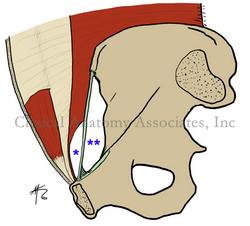 Myopectineal orifice of Fruchaud