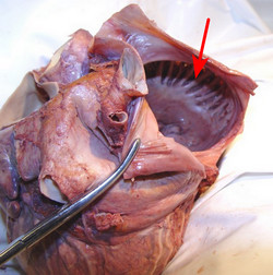 Right atrium, arrow points to the pectinated muscle