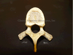 Thoracic vertebra, inferior view. The red rectangles show the location of the vertebral pedicles