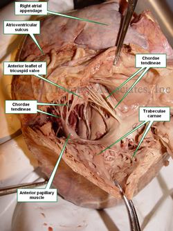 Interior of the right ventricle - Human heart