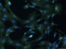Murine somatic cells of mesenchymal origin. Image courtesy of Dr. O'Garcia