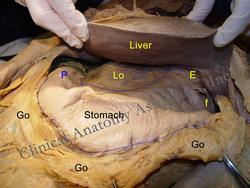 Abdominal dissection