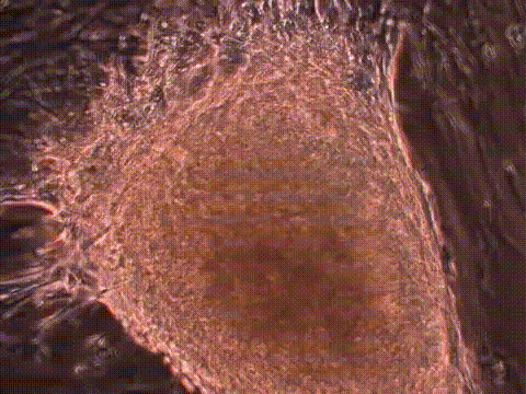 cardiac cell showing automatic contractions